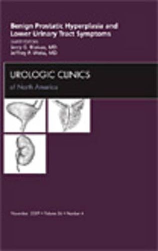 Cover image for Benign Prostatic Hyperplasia and Lower Urinary Tract Symptoms, An Issue of Urologic Clinics