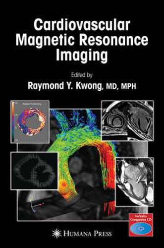 Cover image for Cardiovascular Magnetic Resonance Imaging