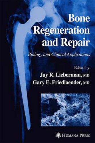 Cover image for Bone Regeneration and Repair: Biology and Clinical Applications