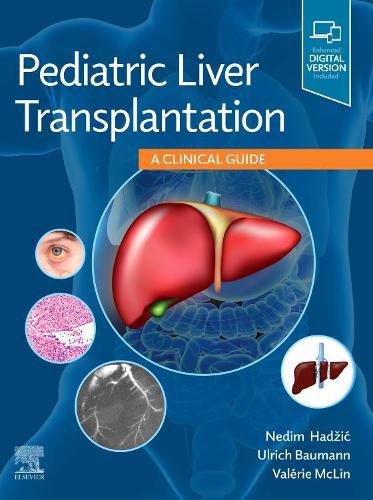 Cover image for Pediatric Liver Transplantation: A Clinical Guide