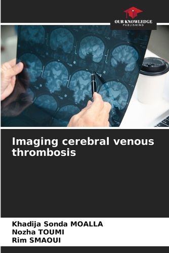 Cover image for Imaging cerebral venous thrombosis