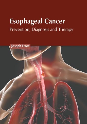 Cover image for Esophageal Cancer: Prevention, Diagnosis and Therapy
