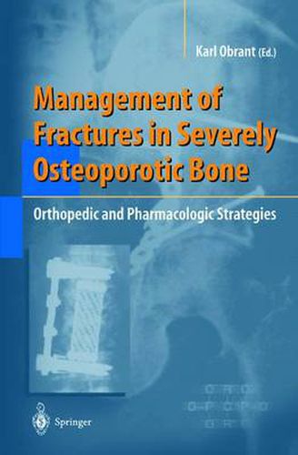 Cover image for Management of Fractures in Severely Osteoporotic Bone: Orthopedic and Pharmacologic Strategies