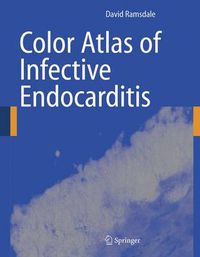 Cover image for Color Atlas of Infective Endocarditis