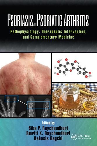 Psoriasis and Psoriatic Arthritis: Pathophysiology, Therapeutic Intervention, and Complementary Medicine