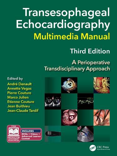 Transesophageal Echocardiography Multimedia Manual