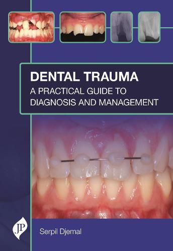 Cover image for Dental Trauma: A Practical Guide to Diagnosis and Management