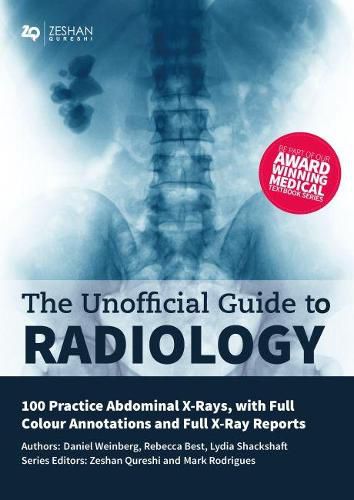 The Unofficial Guide to Radiology: 100 Practice Abdominal X Rays with Full Colour Annotations and Full X Ray Reports