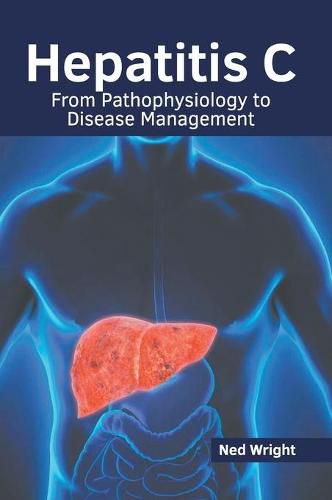 Cover image for Hepatitis C: From Pathophysiology to Disease Management