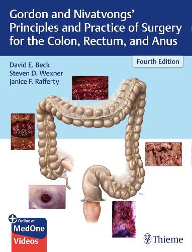 Cover image for Gordon and Nivatvongs' Principles and Practice of Surgery for the Colon, Rectum, and Anus