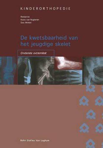 Cover image for de Kwetsbaarheid Van Het Jeugdige Skelet: Onderste Extremiteit