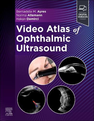 Cover image for Video Atlas of Ophthalmic Ultrasound