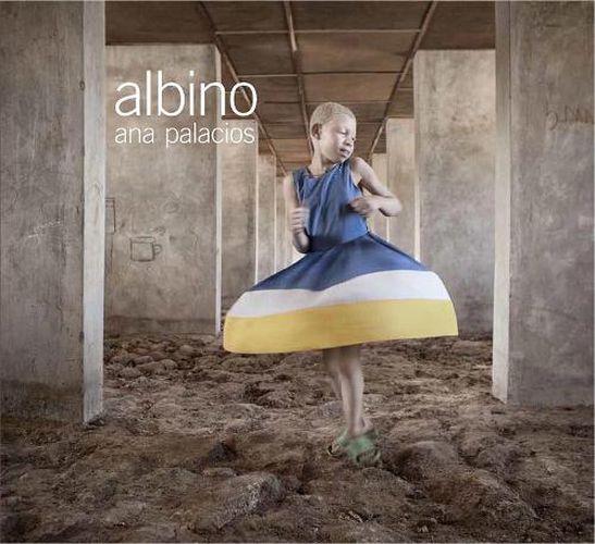 Cover image for Albino