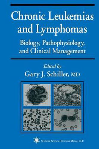 Chronic Leukemias and Lymphomas: Biology, Pathophysiology, and Clinical Management