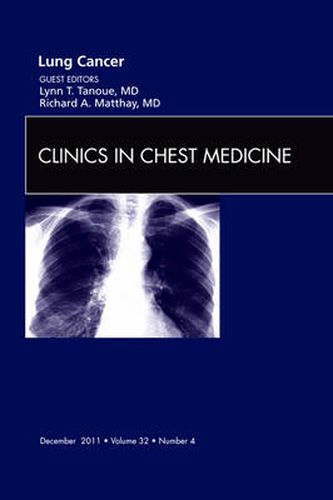 Cover image for Lung Cancer, An Issue of Clinics in Chest Medicine