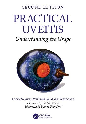 Cover image for Practical Uveitis