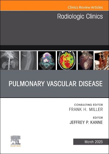 Cover image for Pulmonary Vascular Disease, An Issue of Radiologic Clinics of North America: Volume 63-2