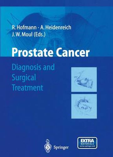 Cover image for Prostate Cancer: Diagnosis and Surgical Treatment