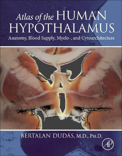 Cover image for Atlas of the Human Hypothalamus: Anatomy, Blood Supply, Myelo-, and Cytoarchitecture