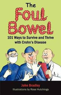 Cover image for The Foul Bowel: 101 Ways to Survive and Thrive With Crohn's Disease