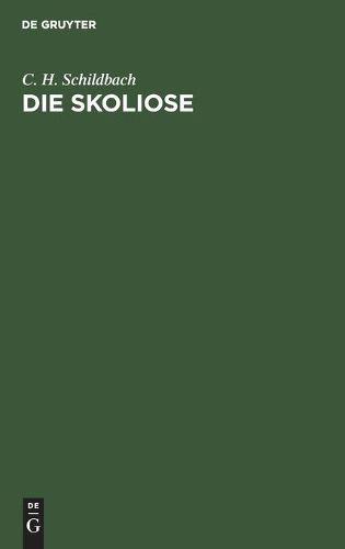 Cover image for Die Skoliose: Anleitung Zur Beurtheilung Und Behandlung Ruckgratsverkrummungen Fur Praktische Aerzte