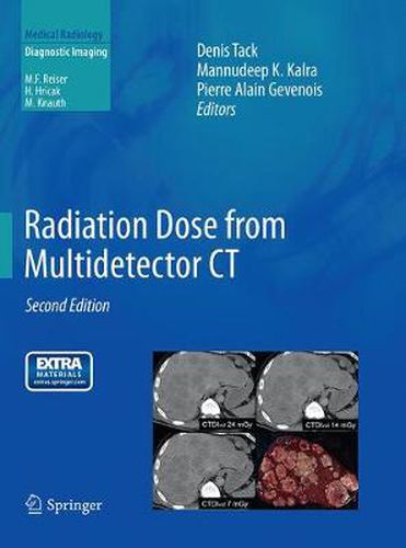 Cover image for Radiation Dose from Multidetector CT