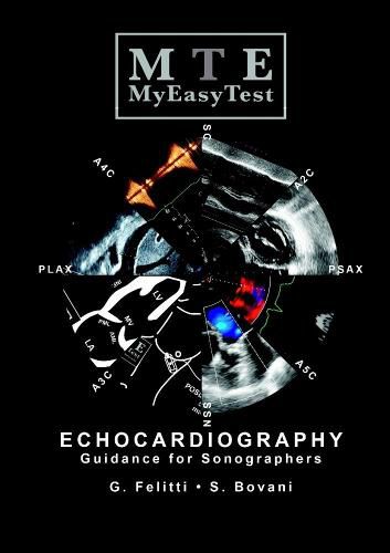 Cover image for Echocardiography - MyEasyTest