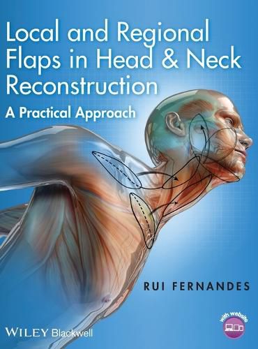 Cover image for Local and Regional Flaps in Head & Neck Reconstruction - A Practical Approach