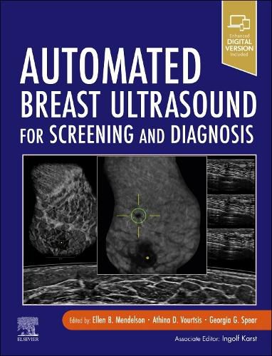 Automated Breast Ultrasound for Screening and Diagnosis, (9780323551236 ...