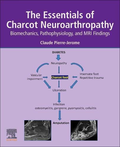 Cover image for The Essentials of Charcot Neuroarthropathy: Biomechanics, Pathophysiology, and MRI Findings