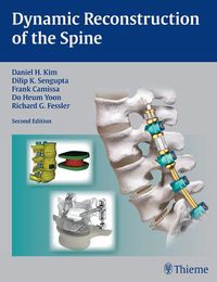 Cover image for Dynamic Reconstruction of the Spine