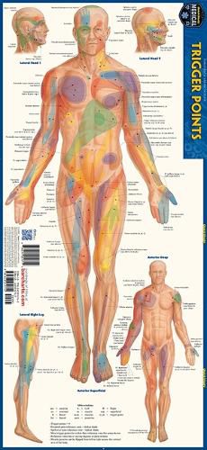 Cover image for Trigger Points