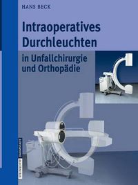 Cover image for Intraoperatives Durchleuchten in Unfallchirurgie und Orthopadie