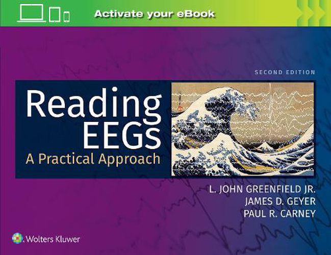 Cover image for Reading EEGs: A Practical Approach