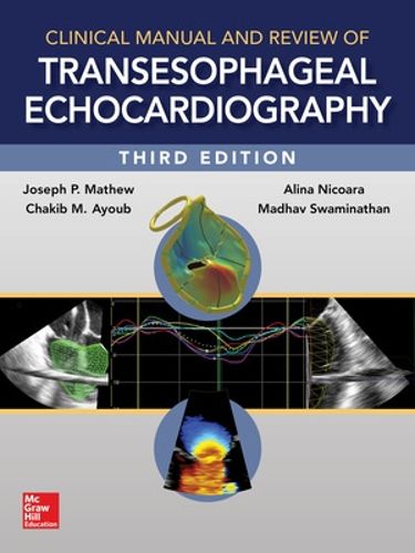 Cover image for Clinical Manual and Review of Transesophageal Echocardiography, 3/e