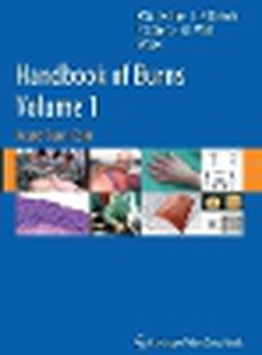 Cover image for Handbook of Burns Volume 1: Acute Burn Care