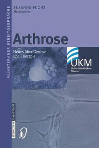 Cover image for Arthrose: Neues UEber Genese Und Therapie