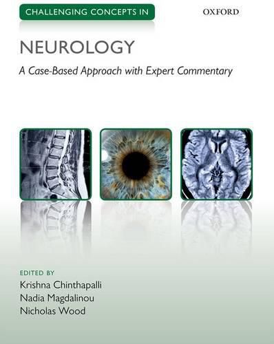 Cover image for Challenging Concepts in Neurology: Cases with Expert Commentary