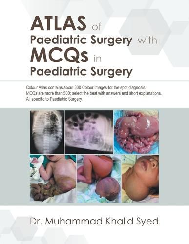 Cover image for Atlas of Paediatric Surgery with MCQS in Paediatric Surgery