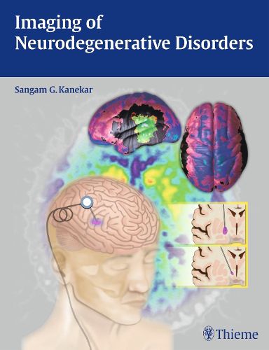 Cover image for Imaging of Neurodegenerative Disorders