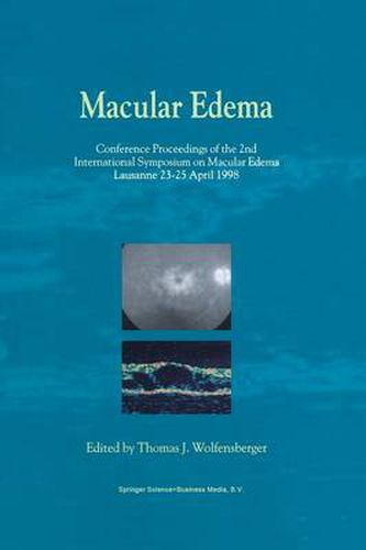 Cover image for Macular Edema: Conference Proceedings of the 2nd International Symposium on Macular Edema, Lausanne, 23-25 April 1998