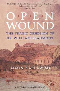 Cover image for Open Wound: The Tragic Obsession of Dr. William Beaumont