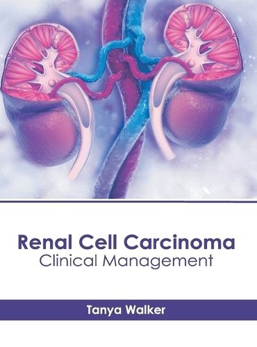 Cover image for Renal Cell Carcinoma: Clinical Management