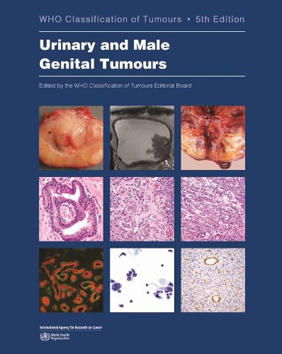 Cover image for Urinary and Male Genital Tumours