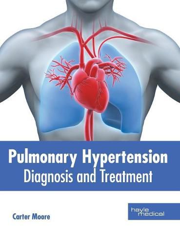 Cover image for Pulmonary Hypertension: Diagnosis and Treatment