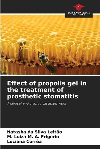 Cover image for Effect of propolis gel in the treatment of prosthetic stomatitis