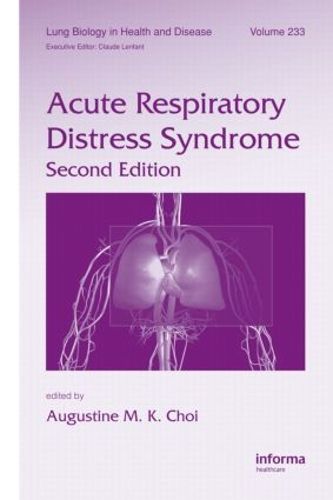Cover image for Acute Respiratory Distress Syndrome