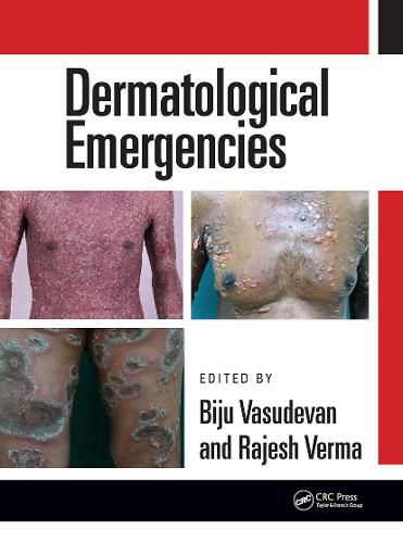 Cover image for Dermatological Emergencies