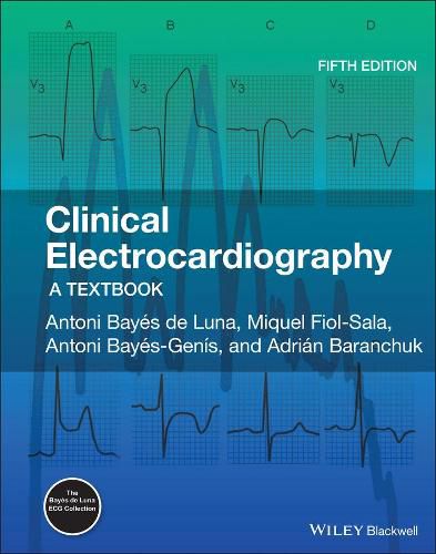 Cover image for Clinical Electrocardiography - A Textbook 5e