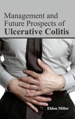 Cover image for Management and Future Prospects of Ulcerative Colitis